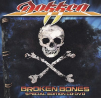 Broken Bones