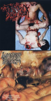 Disgusting Gore And Pathology / Polymorphisms To Severe Sepsis In Trauma