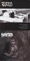 General Surgery / Machetazo