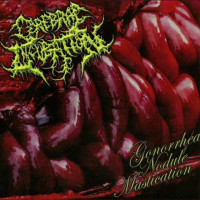 Gonorrhea Nodule Mastication