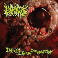 Infected Internal Cyst Eruption